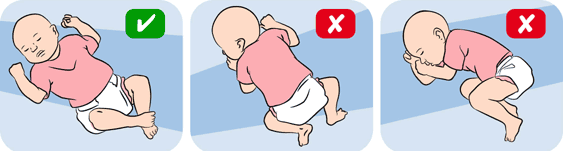 Để phòng đột tử ở trẻ sơ sinh, cần đặt trẻ nằm ngửa khi ngủ