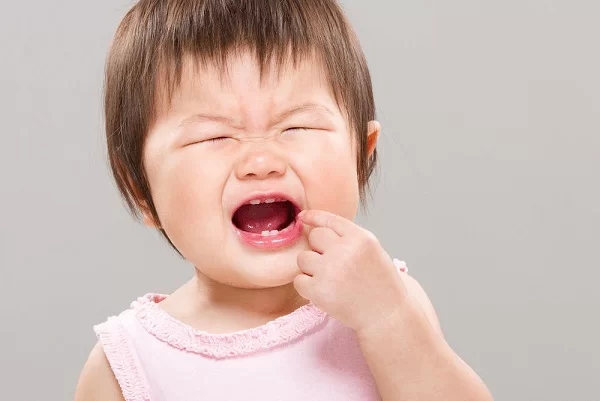 trẻ bị đau răng