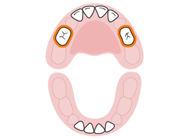 Những chiếc răng hàm đầu tiên