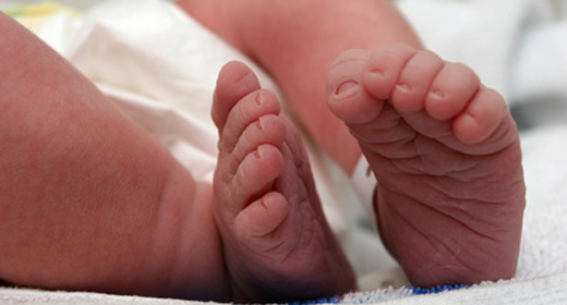 Nguyên nhân khoèo chân ở trẻ sơ sinh – Cẩm nang Bibo Mart